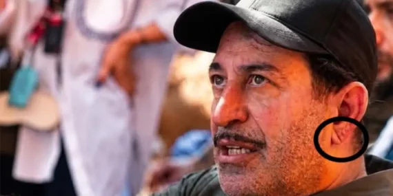 Cem Yılmaz’ın Kalp Krizi Sonrası Herkes Kulak Memesindeki Detayı Konuşuyor