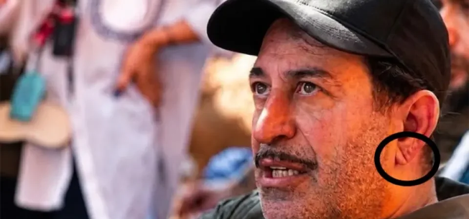 Cem Yılmaz’ın Kalp Krizi Sonrası Herkes Kulak Memesindeki Detayı Konuşuyor